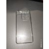 Чехол (клип-кейс) DF xiCase-62 для Xiaomi Redmi Note 11 Pro/11 Pro 5G синий